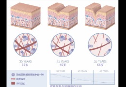 都在問的乙酰殼糖胺（NAG）功效怎么樣？功效成分的護(hù)膚品應(yīng)該怎么選？